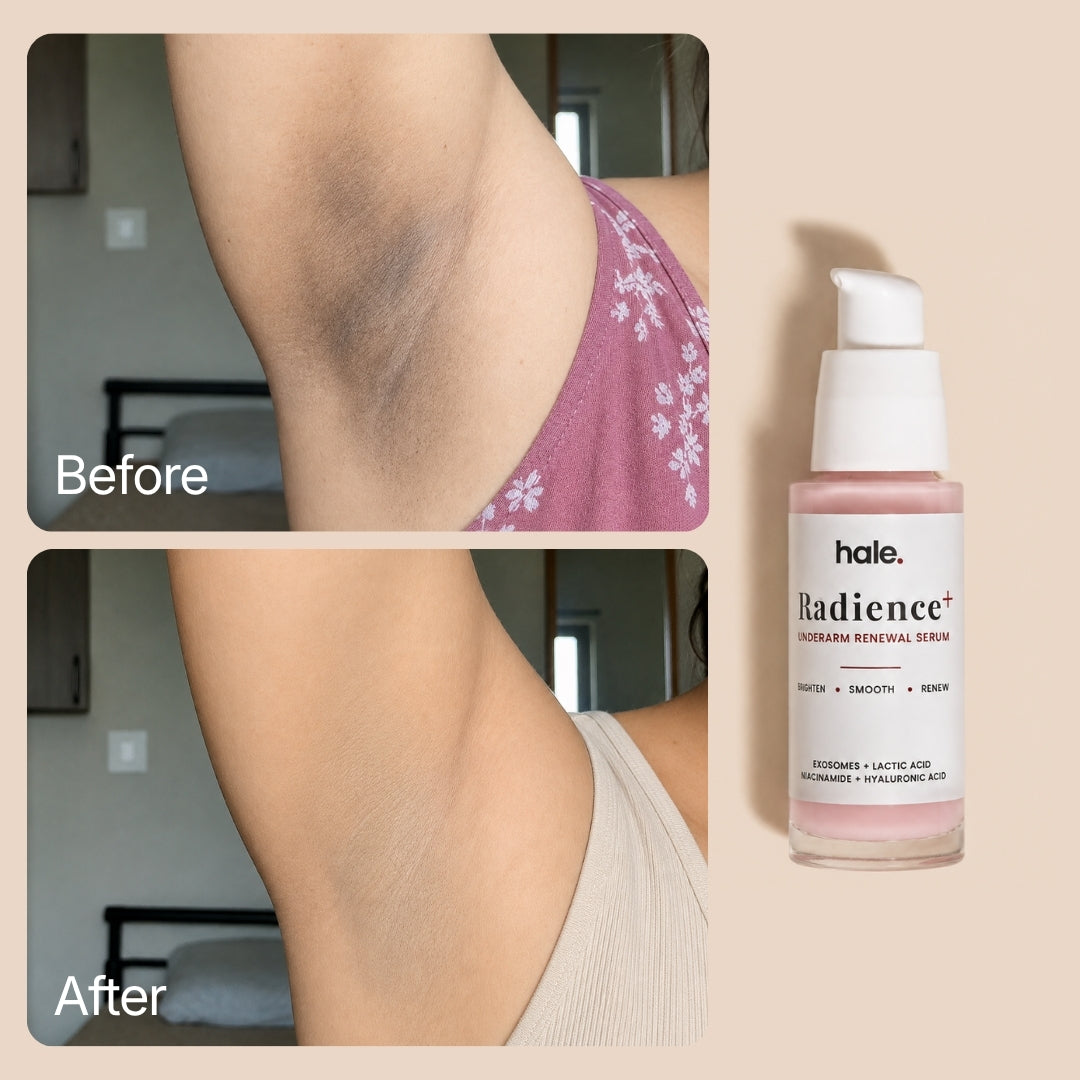 Hale Radiance +